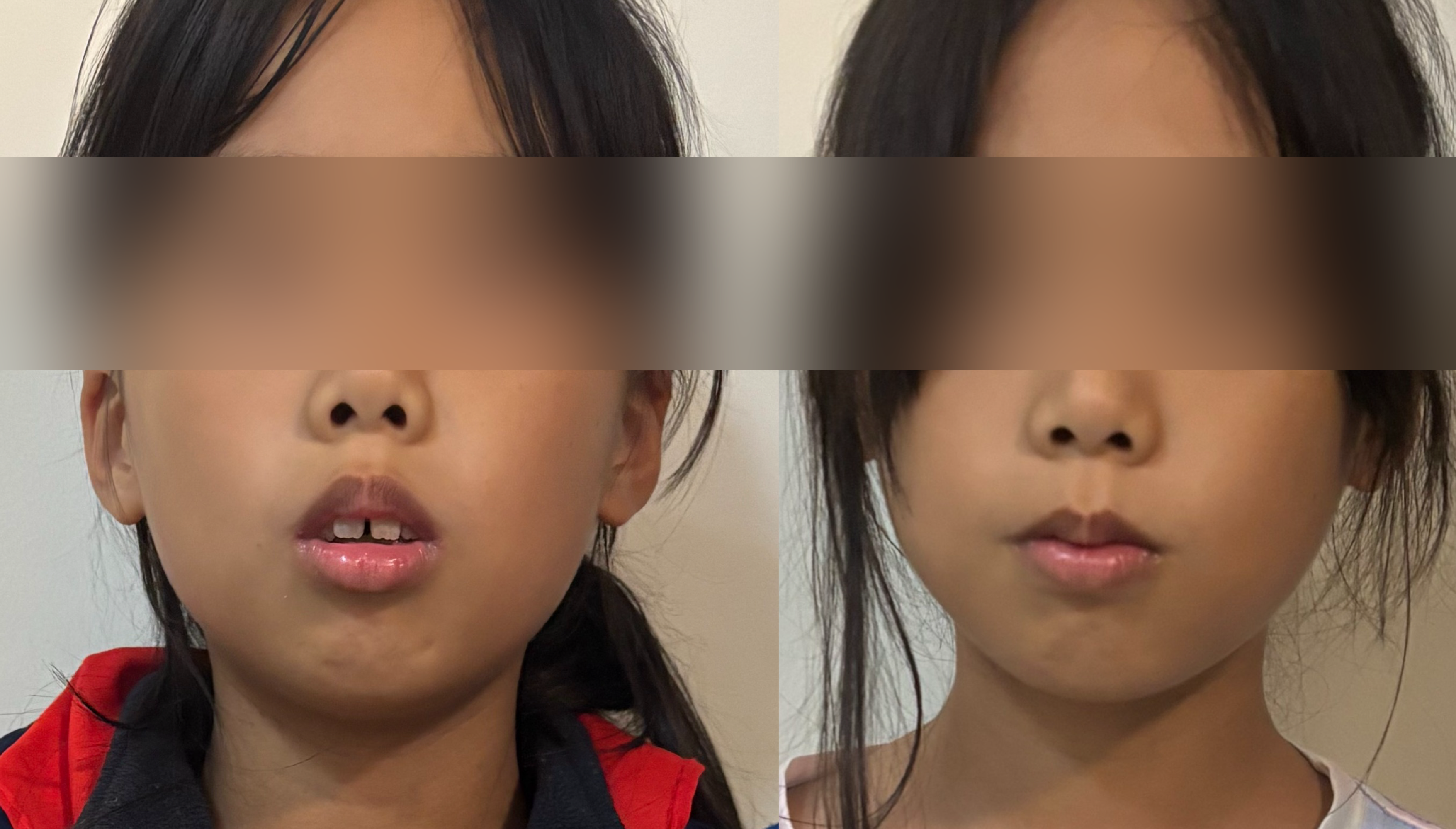 8岁孩子训练前后对比